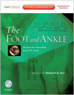 AANA Advanced Arthroscopy: The Foot and Ankle E-Book AANA Advanced Arthroscopy: The Foot and Ankle E-Book