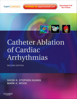 Catheter Ablation of Cardiac Arrhythmias E-book Catheter Ablation of Cardiac Arrhythmias E-book