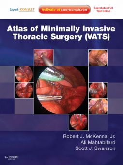 Atlas of Minimally Invasive Thoracic Surgery (VATS) E-Book