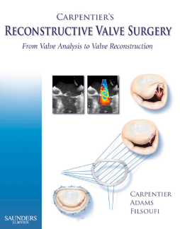 Carpentier's Reconstructive Valve Surgery E-Book Carpentier's Reconstructive Valve Surgery E-Book