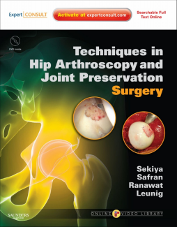 SD - Techniques in Hip Arthroscopy and Joint Preservation Surgery E-Book SD - Techniques in Hip Arthroscopy and Joint Preservation Surgery E-Book
