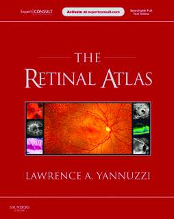 SPEC - The Retinal Atlas, 1st Edition, 12-Month Access, eBook SPEC - The Retinal Atlas, 1st Edition, 12-Month Access, eBook