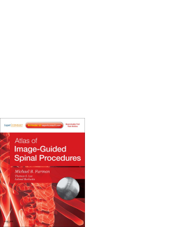SPEC - Atlas of Image-Guided Spinal Procedures E-Book 12 Month Subscription SPEC - Atlas of Image-Guided Spinal Procedures E-Book 12 Month Subscription