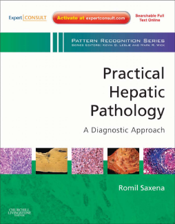 Practical Hepatic Pathology: A Diagnostic Approach E-Book