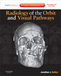 Radiology of the Orbit and Visual Pathways E-Book