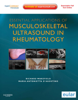 Essential Applications of Musculoskeletal Ultrasound in Rheumatology E-Book Essential Applications of Musculoskeletal Ultrasound in Rheumatology E-Book
