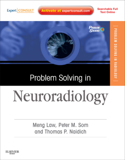 Problem Solving in Neuroradiology E-Book Problem Solving in Neuroradiology E-Book