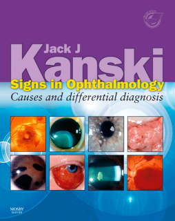 Signs in Ophthalmology: Causes and Differential Diagnosis E-Book