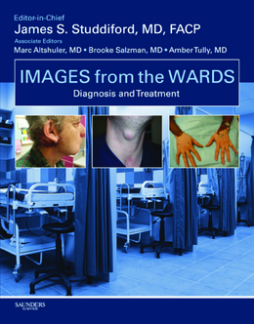 Images from the Wards: Diagnosis and Treatment E-Book