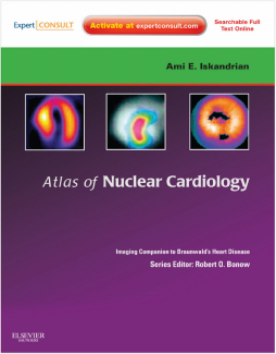 Atlas of Nuclear Cardiology: Imaging Companion to Braunwald's Heart Disease E-Book Atlas of Nuclear Cardiology: Imaging Companion to Braunwald's Heart Disease E-Book