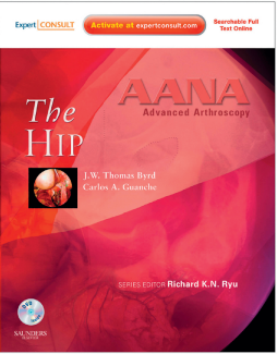 AANA Advanced Arthroscopy: The Hip E-Book AANA Advanced Arthroscopy: The Hip E-Book
