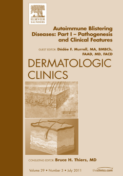 AutoImmune Blistering Disease Part I, An Issue of Dermatologic Clinics - E-Book AutoImmune Blistering Disease Part I, An Issue of Dermatologic Clinics - E-Book