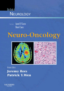 SD - Neuro-Oncology E-Book SD - Neuro-Oncology E-Book