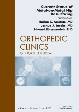 Current Status of Metal-on-Metal Hip Resurfacing, An Issue of Orthopedic Clinics - E-Book Current Status of Metal-on-Metal Hip Resurfacing, An Issue of Orthopedic Clinics - E-Book