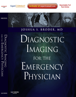 Diagnostic Imaging for the Emergency Physician E-Book Diagnostic Imaging for the Emergency Physician E-Book