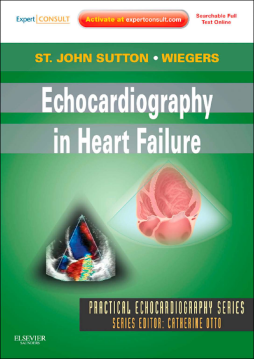 Echocardiography in Heart Failure- E-BOOK Echocardiography in Heart Failure- E-BOOK