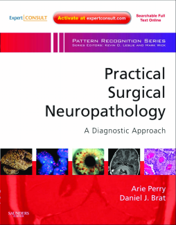 Practical Surgical Neuropathology: A Diagnostic Approach E-Book Practical Surgical Neuropathology: A Diagnostic Approach E-Book