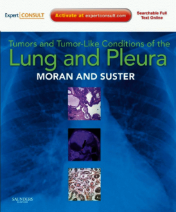 SD - Tumors and Tumor-like Conditions of the Lung and Pleura E-Book SD - Tumors and Tumor-like Conditions of the Lung and Pleura E-Book