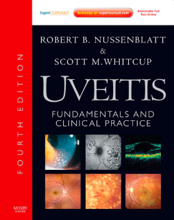 Uveitis E-Book Uveitis E-Book
