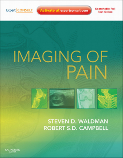 Imaging of Pain E-Book