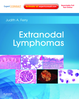 Extranodal Lymphomas E-Book Extranodal Lymphomas E-Book