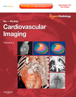 Cardiovascular Imaging E-Book