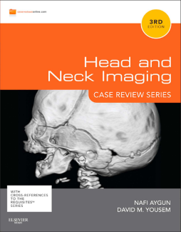 Head & Neck Imaging: Case Review Series