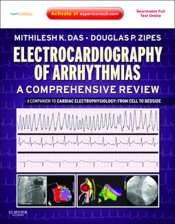 Electrocardiography of Arrhythmias: A Comprehensive Review E-Book