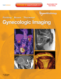 Gynecologic Imaging E-Book Gynecologic Imaging E-Book