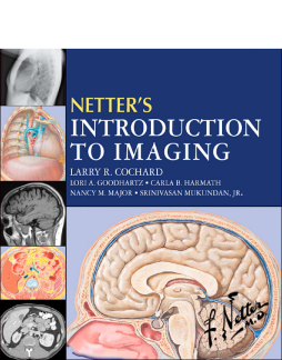 Netter's Introduction to Imaging E-Book Netter's Introduction to Imaging E-Book