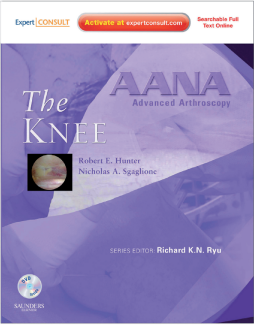 AANA Advanced Arthroscopy: The Knee E-Book AANA Advanced Arthroscopy: The Knee E-Book