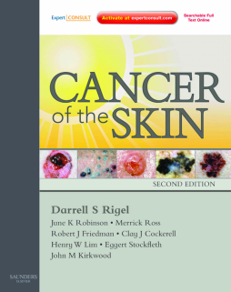 Cancer of the Skin E-Book Cancer of the Skin E-Book