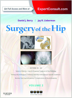 Surgery of the Hip E-Book Surgery of the Hip E-Book
