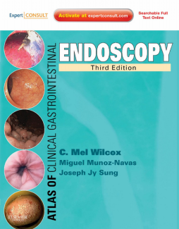Atlas of Clinical Gastrointestinal Endoscopy E-Book Atlas of Clinical Gastrointestinal Endoscopy E-Book