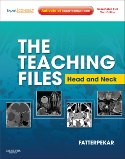 The Teaching Files: Head and Neck Imaging E-Book The Teaching Files: Head and Neck Imaging E-Book