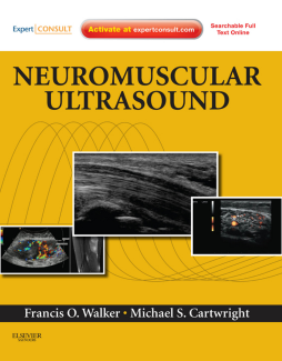 Neuromuscular Ultrasound E-Book Neuromuscular Ultrasound E-Book