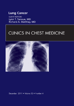Lung Cancer, An Issue of Clinics in Chest Medicine - E-Book
