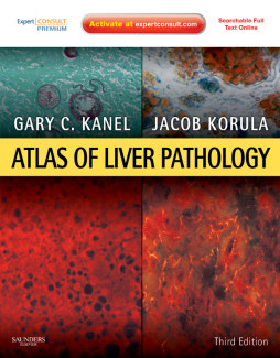 Atlas of Liver Pathology E-Book Atlas of Liver Pathology E-Book