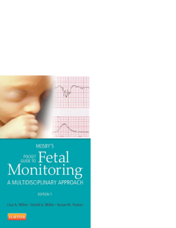 Mosby's Pocket Guide to Fetal Monitoring - E-Book Mosby's Pocket Guide to Fetal Monitoring - E-Book