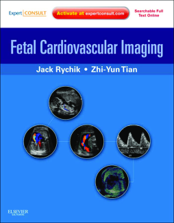 Fetal Cardiovascular Imaging E-Book Fetal Cardiovascular Imaging E-Book