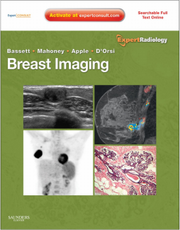 Breast Imaging Expert Radiology Series E-Book Breast Imaging Expert Radiology Series E-Book
