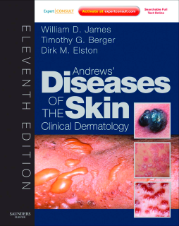 SPEC - Andrews' Diseases of the Skin E-Book 12Month Subscription SPEC - Andrews' Diseases of the Skin E-Book 12Month Subscription