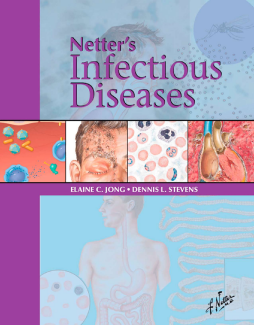Netter's Infectious Diseases E-Book Netter's Infectious Diseases E-Book