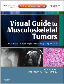Visual Guide to Musculoskeletal Tumors: A Clinical - Radiologic - Histologic Approach E-BOOK