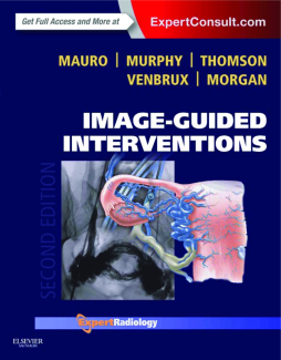 Image-Guided Interventions E-Book Image-Guided Interventions E-Book