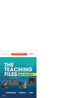 The Teaching Files: Brain and Spine Imaging E-Book The Teaching Files: Brain and Spine Imaging E-Book