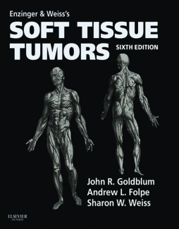 Enzinger and Weiss's Soft Tissue Tumors E-Book Enzinger and Weiss's Soft Tissue Tumors E-Book