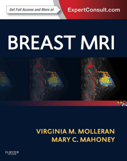 Breast MRI E-Book Breast MRI E-Book