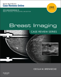 Breast Imaging: Case Review Series E-Book Breast Imaging: Case Review Series E-Book