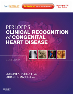 Clinical Recognition of Congenital Heart Disease E-Book Clinical Recognition of Congenital Heart Disease E-Book